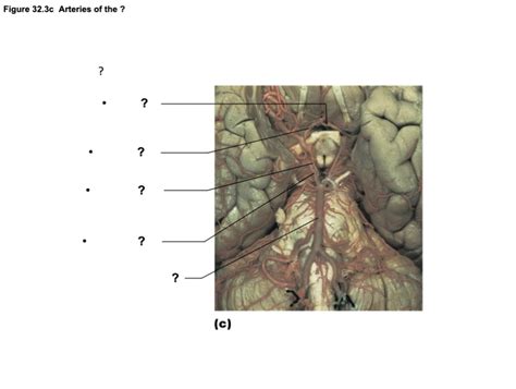 Bsc L Arteries Of The Head Neck Brain Diagram Quizlet