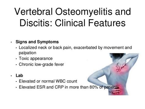 Discitis And Osteomyelitis In Sickle Cell Disease