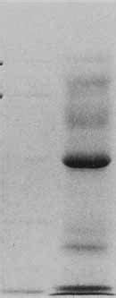 Purification Of Gelatinuse From Human Neutrophils By Substrate U F I N