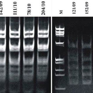 Polyacrylamide Gel Showing Tru I Left And Alui Right Rflp Patterns