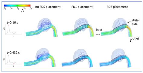 Fluids Free Full Text Hemodynamic Investigation Of The Flow