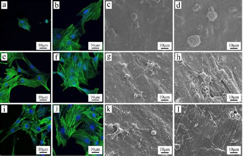 Clsm Photos Of Cytoskeletal Morphology And Spreading Of Mc3t3 E1 Cells