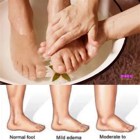 Why do ankles hurt and what to do at home tips