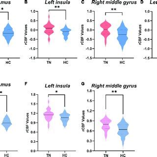 Significant Correlations Between The Regional Cerebral Blood Flow