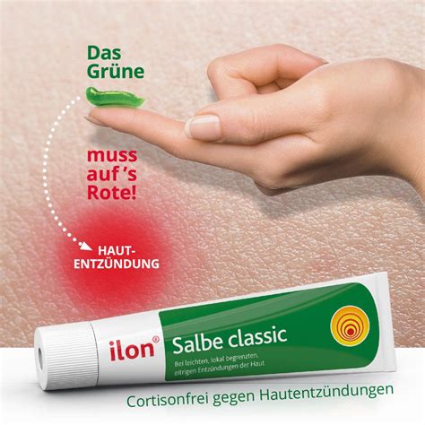 Ilon Salbe Classic Bei Entz Ndungen Der Haut G Shop Apotheke