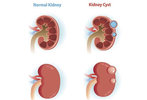 Urologist Singapore Urohealth Medical Clinic