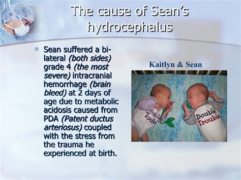 Hydrocephalus And Shunts Seans Story