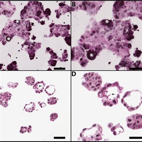 Morphology Of Mcf 7 Cells Grown In 2d And 3d Cultures Mcf 7 Human Download Scientific Diagram