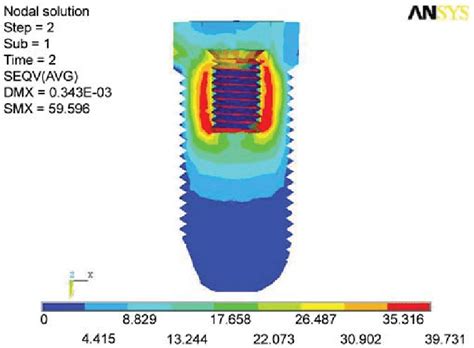 Stress Distribution In Abutment 10n Horizontal Download Scientific Diagram