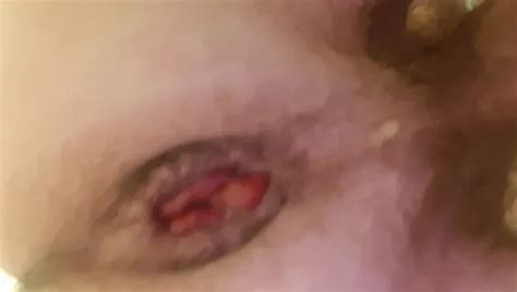Fisting My Asshole Gay Glory Hole Amateur Porn Feat Analsau XHamster