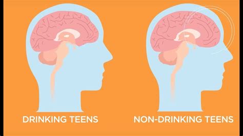 The Effects Of Alcohol On Teenage Brain Development