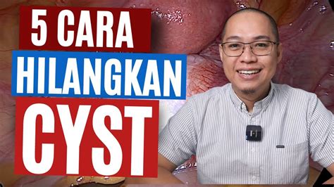 Ovarian Cyst Punca Rawatan Cyst Berkesan Tapi Semulajadi Youtube