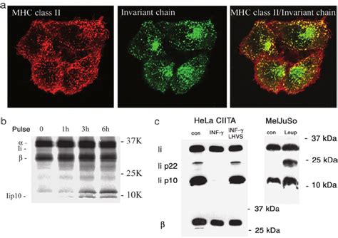 Invariant Chain Degradation A Immuno Fl Uorescence Microscopy Of