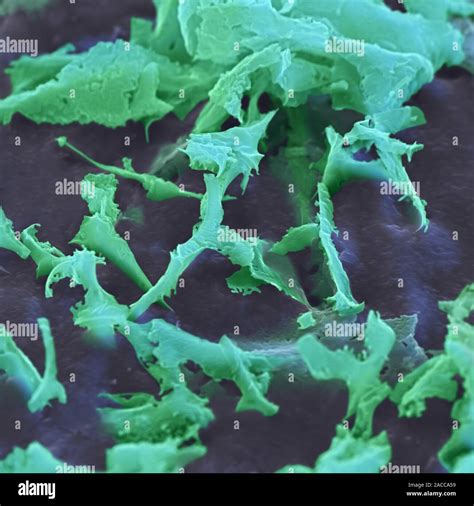 La Endotoxina De Escherichia Coli Color Micrografía Análisis De