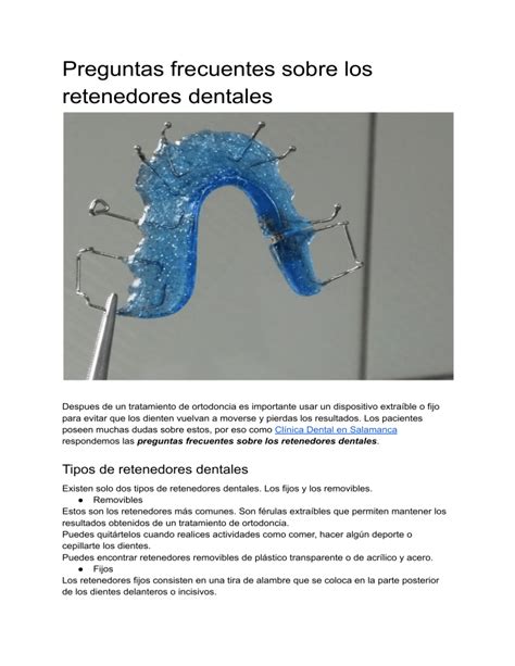 Preguntas Frecuentes Sobre Los Retenedores Dentales