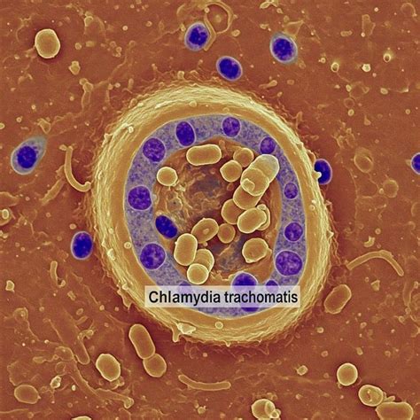 chlamydia test treatment  derma clinic kathmandu nepal