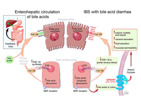 The Role Of Bile Acids In Chronic Diarrhea PMC