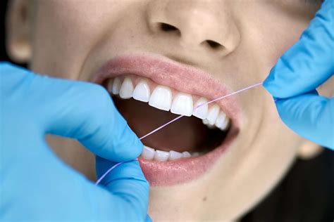 How Often Do You Need Teeth Cleaning? - Thornhill Dental Office