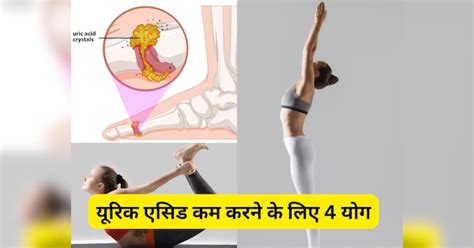 These 4 Yoga Asanas Are Very Effective In Reducing Uric Acid Include