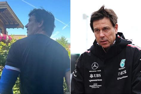 Toto Wolff Cade Ancora Dalla Bici E Si Frattura Il Gomito Disavventura