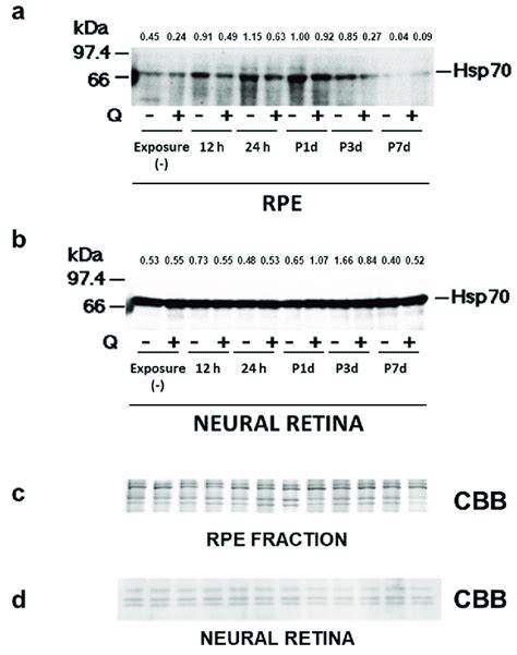 Expression Of Heat Shock Protein 70 Hsp70 Hsp70 Specific Labeling Of