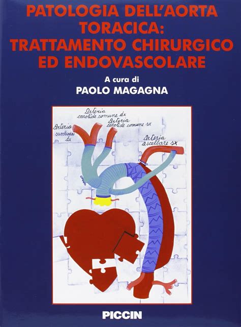 Patologia Dell Aorta Toracica Trattamento Chirurgico Ed Endovascolare