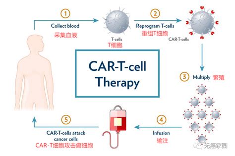 CAR T细胞免疫疗法 CAR T治疗让晚期癌症患者获得重生 CAR T临床试验招募进行中 全球肿瘤医生网