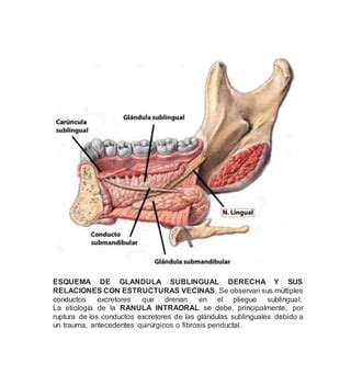 Manejo Quir Rgico De La Ranula Intraoral Pdf