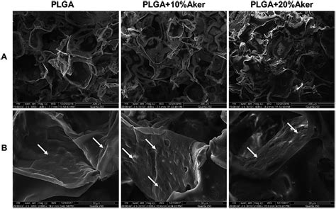 Bioceramic Akermanite Enhanced Vascularization And Osteogenic