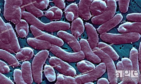 VIBRIO VULNIFICUS This Scanning Electron Micrograph SEM Depicts A