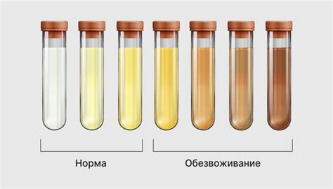 Почему моча становится бесцветной? Врачи объясняют причины