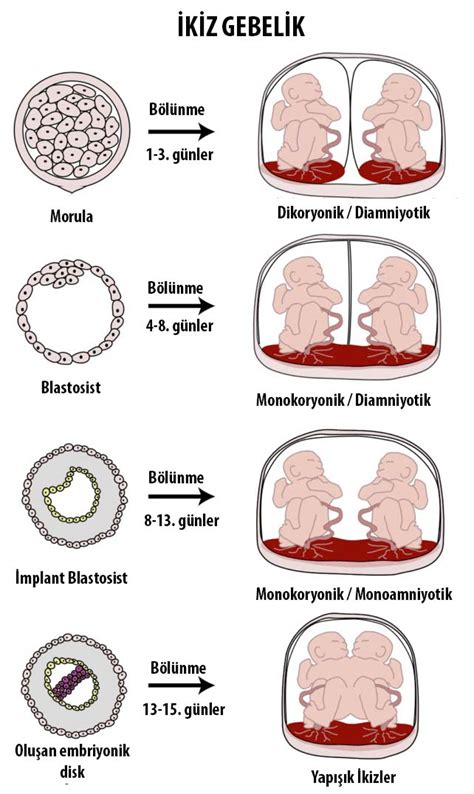 İkiz Gebelik İkiz Gebelik Belirtileri Op Dr Gönül Çimen