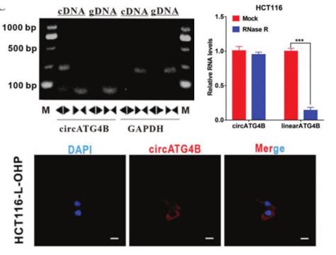 Advanced Science 外泌体circrna可编码新型蛋白质诱导结直肠癌细胞自噬并产生奥沙利 哔哩哔哩