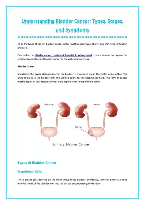 Ppt Everything About Bladder Cancer Powerpoint Presentation Free