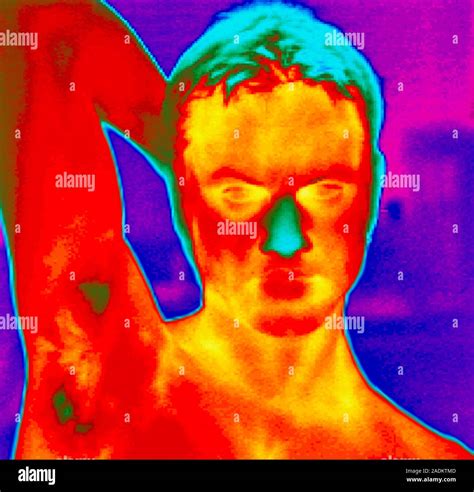 Head And Shoulders Thermogram Of A Man S Head And Shoulders Showing