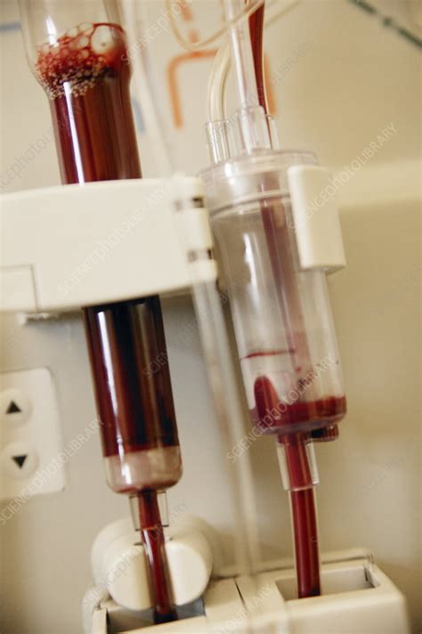 Kidney Dialysis Machine Stock Image M4950108 Science Photo Library