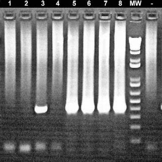 Ethidium Bromide Stained Agarose Gel Showing Pcr Products Amplified