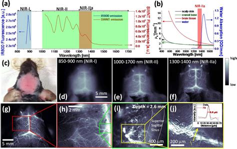 Noninvasive fluorescence-based brain imaging | SPIE Homepage: SPIE