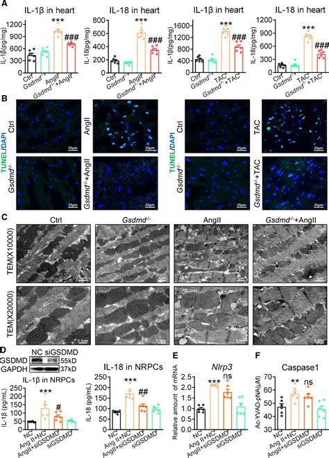 GSDMD Gasdermin D Mediates Pathological Cardiac Hypertrophy And