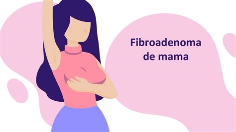 Fibroadenoma De Mama Orlando Moreno Udocz