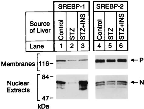 Insulin Selectively Increases Srebp 1c Mrna In The Livers Of Rats With