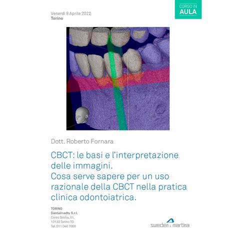 Cbct Le Basi E Linterpretazione Delle Immagini Dr Roberto Fornara