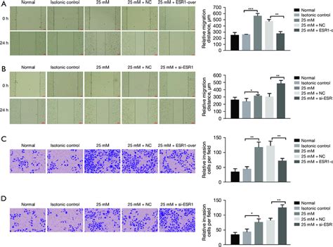 Effect Of ESR1 On HepG2 Migration And Invasion A B Cell Migration