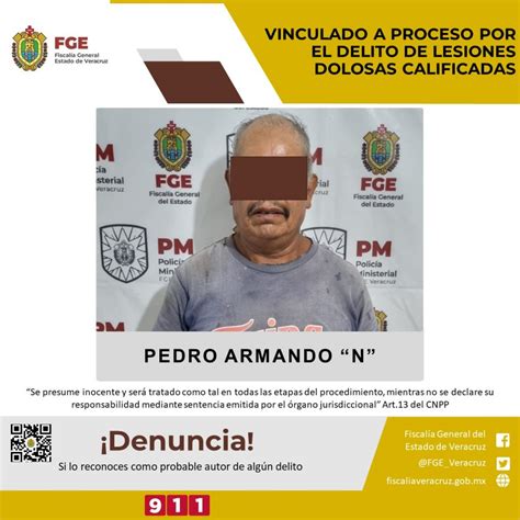 Vinculado A Proceso Por El Presunto Delito De Lesiones Dolosas