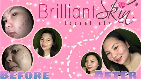 2 Weeks Of Using BRILLIANT SKIN REJUVENATING SET HONEST REVIEW Glaiza