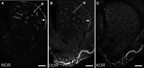 Distributional Patterns Of Mor Dor And Kor In The Striosome Matrix