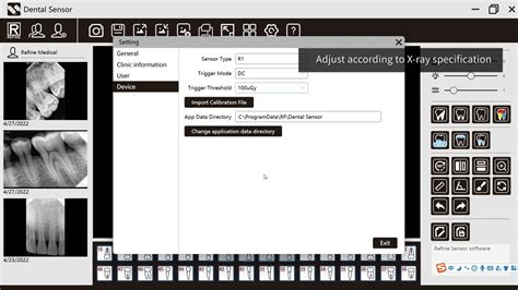 Device Setting And Calibration File Import In The Operation Of Refine