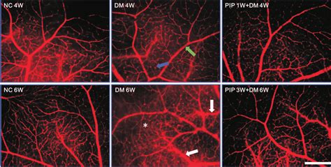 Representative Photographs Of Evans Blue In The Mouse Retina Normal