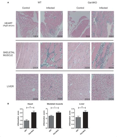 Scoring Of Tissue Inflammation By Histopathology A Representative Download Scientific