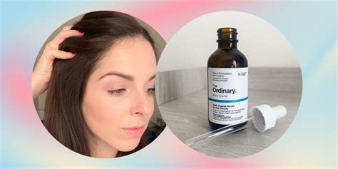 The Ordinary hair serum saved my scalp and improved growth